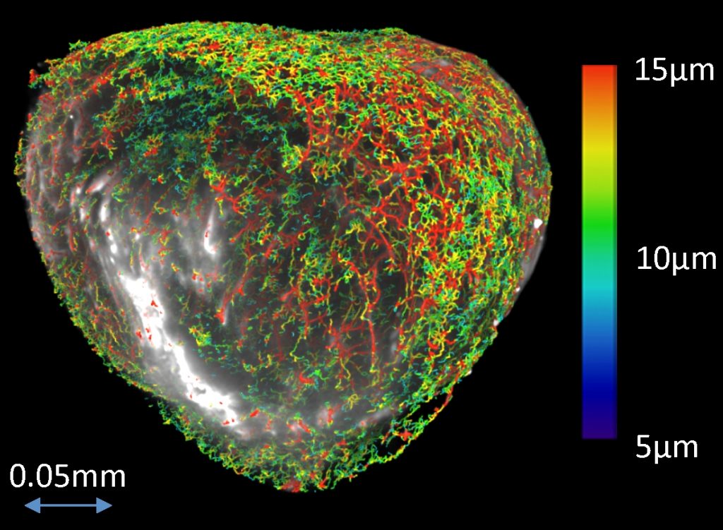 Blood vessels in a mouse colorectal xenograft model