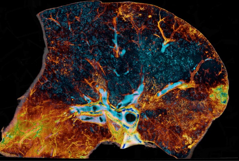 Image of a COVID-19-injured lung where blue represents open airways.